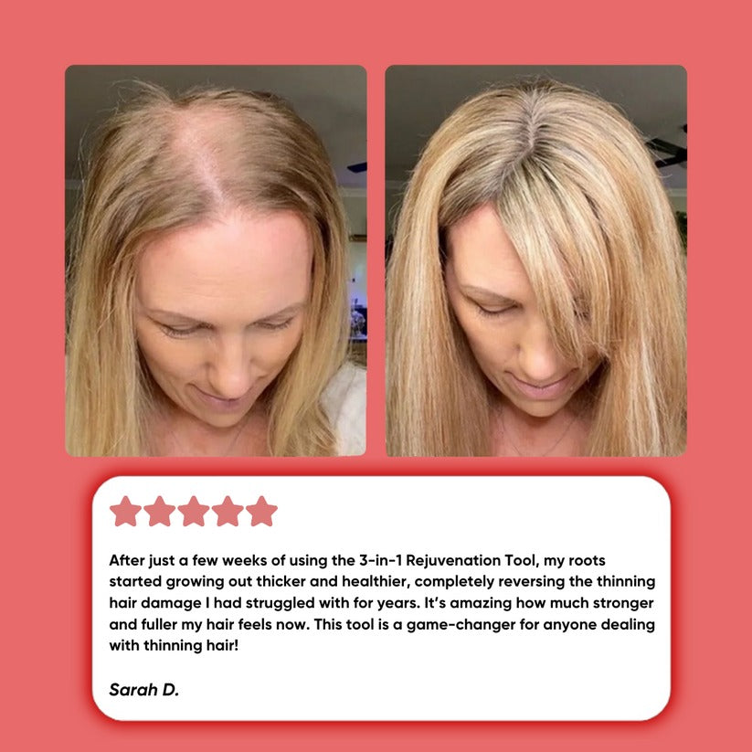 HairyAgain® Hair Growth Comb 2.0