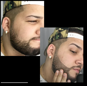 HairyAgain© Beard Pencil Bundle (Includes 4 Free Gifts)