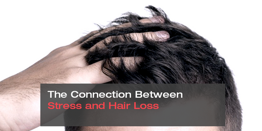 The Connection Between Stress and Hair Loss