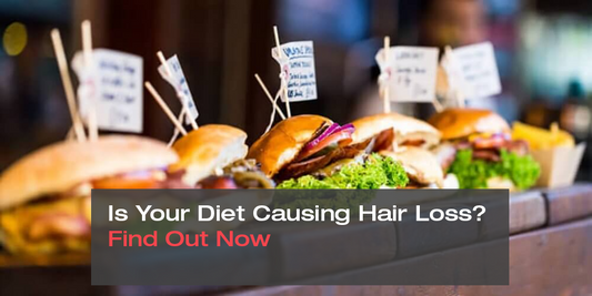 Is Your Diet Causing Hair Loss? Find Out Now