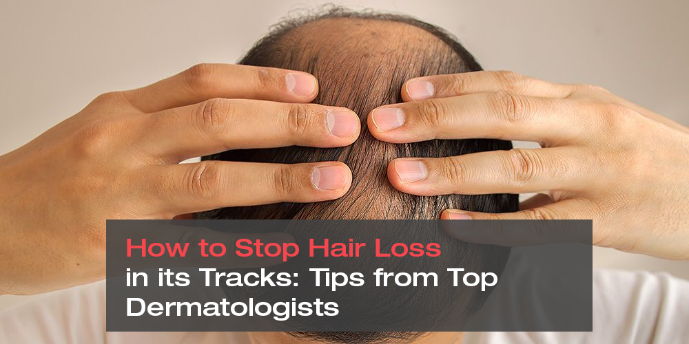 How to Stop Hair Loss in its Tracks: Tips from Top Dermatologists