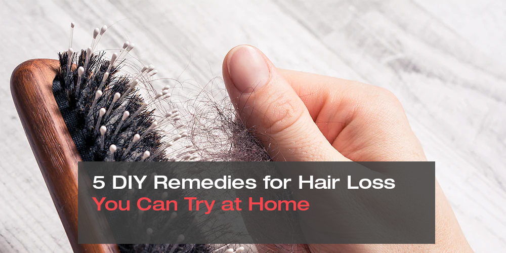 5 DIY Remedies for Hair Loss You Can Try at Home