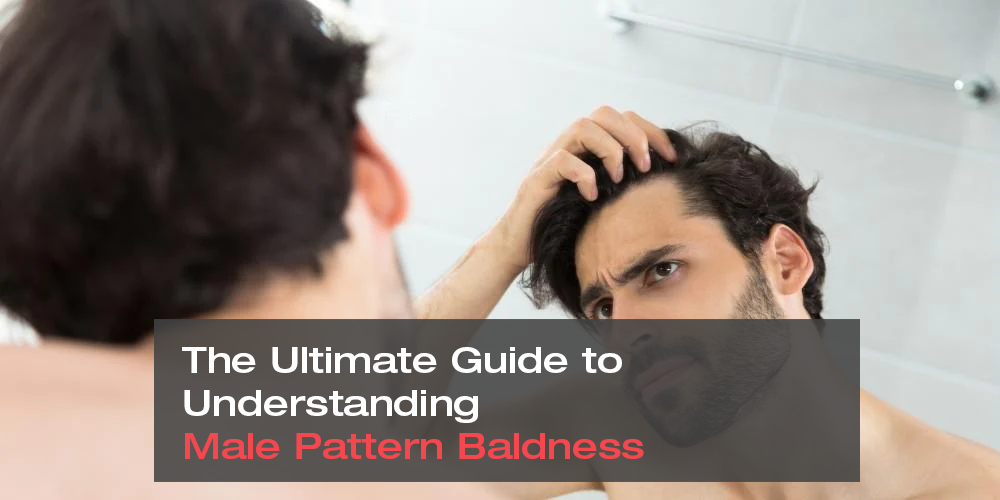 The Ultimate Guide to Understanding Male Pattern Baldness