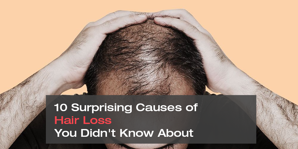 10 Surprising Causes of Hair Loss You Didn't Know About