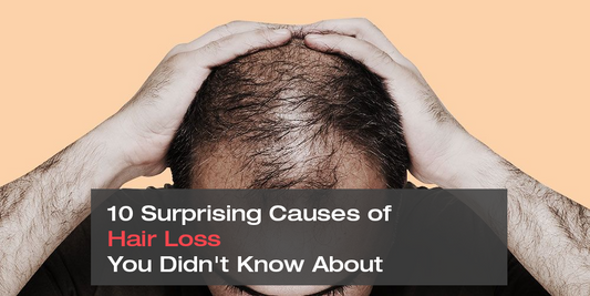 10 Surprising Causes of Hair Loss You Didn't Know About