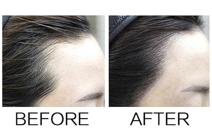 Hair line Filler Corrector - HairyAgain™