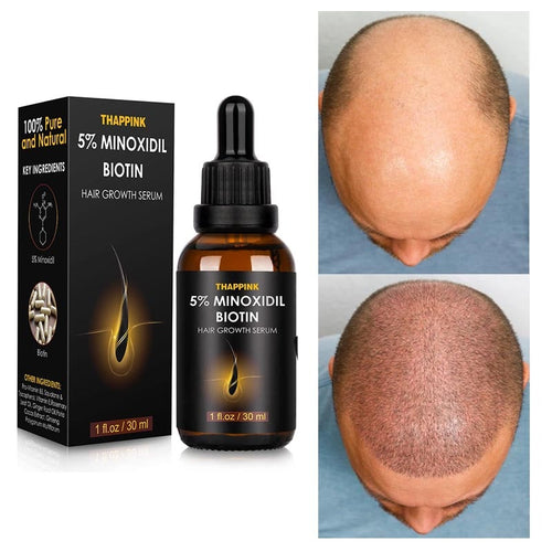 5% Minoxidil Extreme Hair Growth